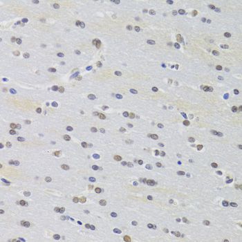 Immunohistochemistry - PRPF3 Polyclonal Antibody (144-05482)