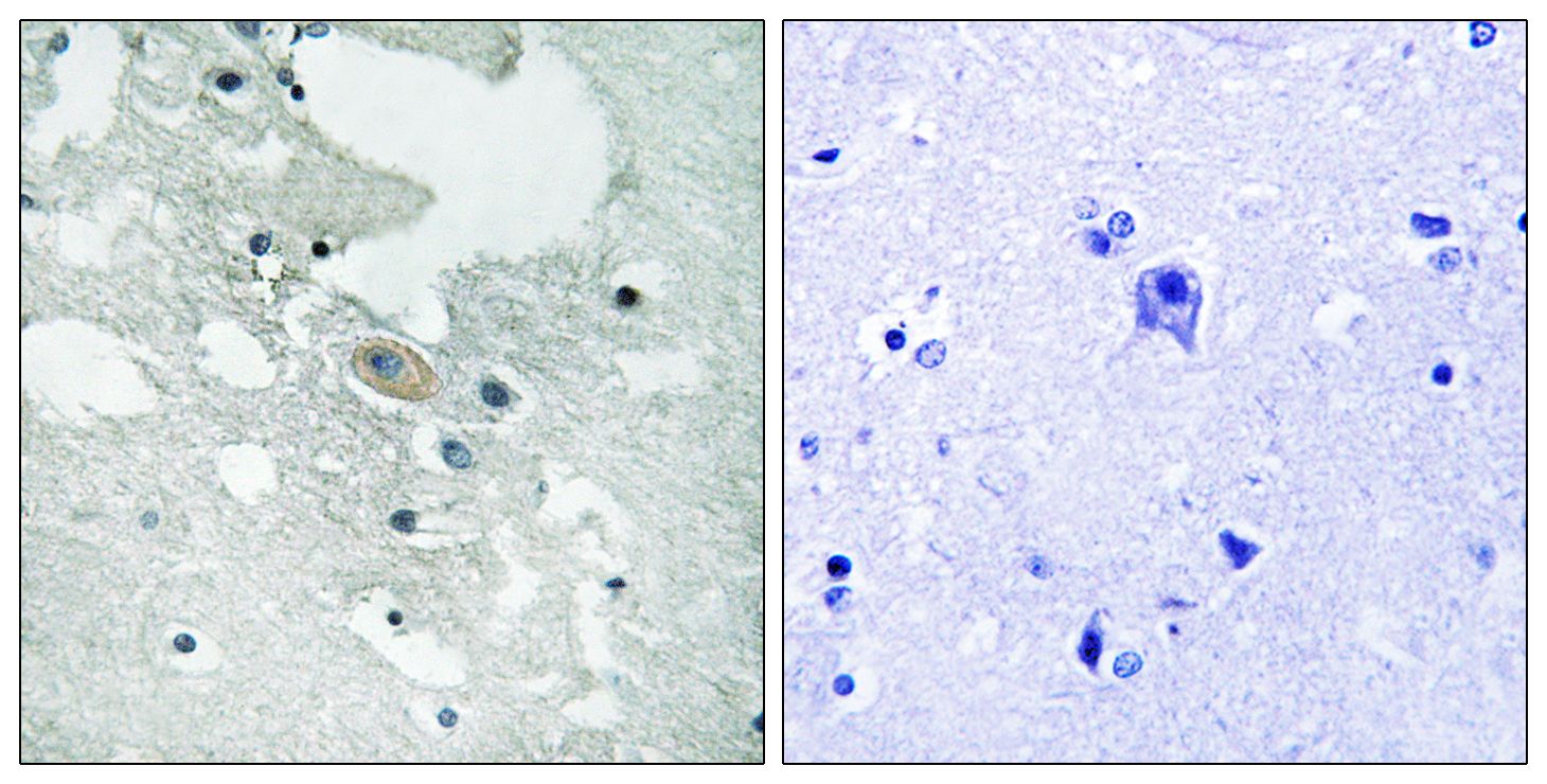 IHC
