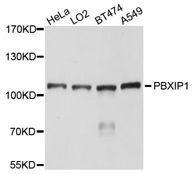 Western blot - PBXIP1 antibody (144-08790)