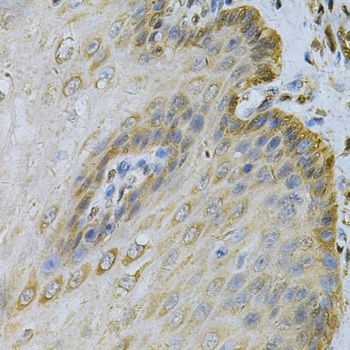 Immunohistochemistry - PGK1 Antibody (144-60560)
