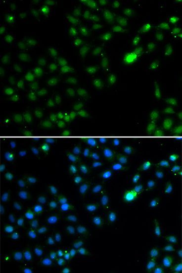 Immunofluorescence - FKBP3 Polyclonal Antibody (144-06907)