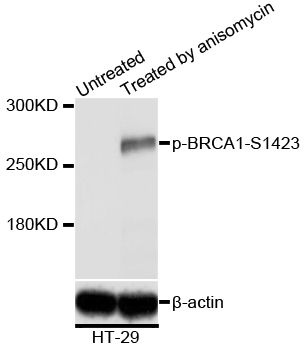 Western blot - Phospho-BRCA1-S1423 pAb (144-50232)