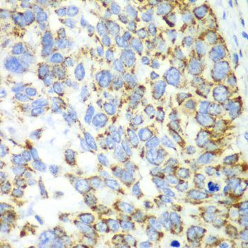 Immunohistochemistry - CHIA Polyclonal Antibody (144-61364)