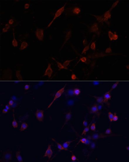 Immunofluorescence - CFL1 antibody (144-01704)
