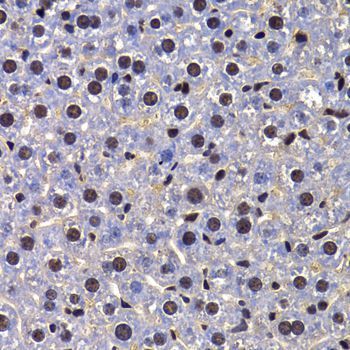 Immunohistochemistry - FIP1L1 Polyclonal Antibody (144-07138)