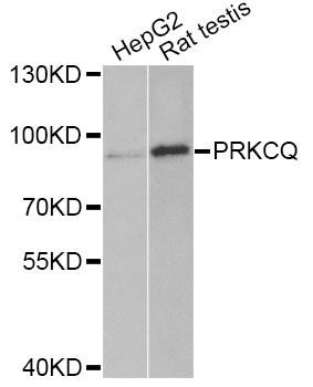 Western blot - PRKCQ Antibody (144-05834)