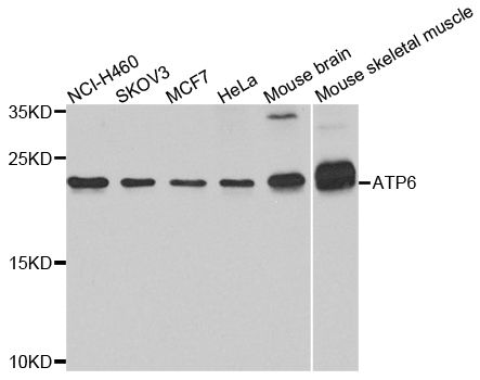 Western blot - ATP6 antibody (144-08193)
