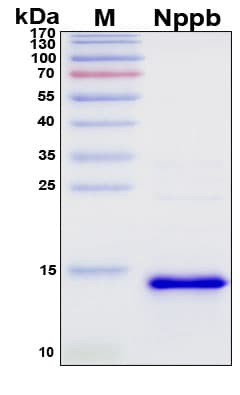 SDS-PAGE Image