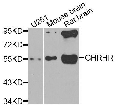 Western blot - GHRHR antibody (144-08421)