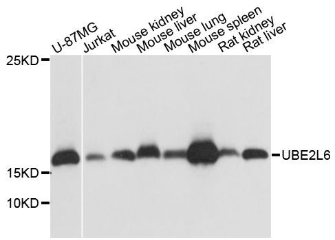 Western blot - UBE2L6 antibody (144-60438)