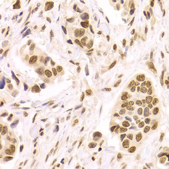 Immunohistochemistry - HMGB1 Polyclonal Antibody (144-02553)