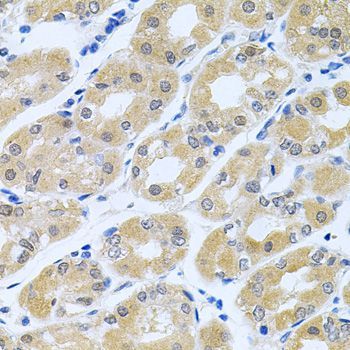 Immunohistochemistry - GNE Polyclonal Antibody (144-08570)