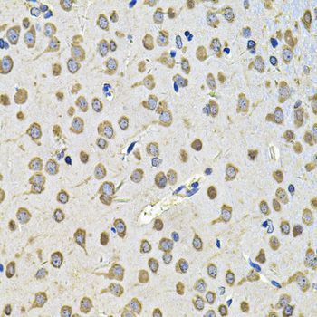 Immunohistochemistry - EIF3F Antibody (144-07023)