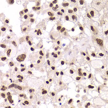 Immunohistochemistry - XRCC6 Polyclonal Antibody (144-00883)