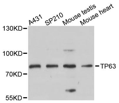Western blot - TP63 Polyclonal Antibody (144-12937)