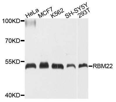 Western blot - RBM22 Polyclonal Antibody (144-010025)