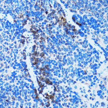 Immunohistochemistry - Caspase3 Polyclonal Antibody (144-60067)