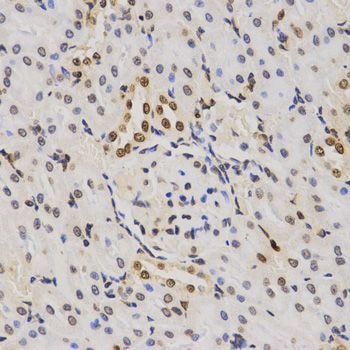 Immunohistochemistry - TriMethyl-Histone H3-K79 pAb (144-61342)