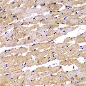 Immunohistochemistry - PSEN2 Polyclonal Antibody (144-07719)