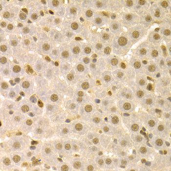 Immunohistochemistry - SFN Polyclonal Antibody (144-01026)
