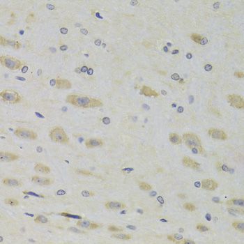 Immunohistochemistry - RPL9 Antibody (144-013632)