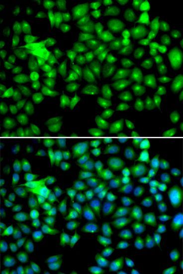 Immunofluorescence - HSPB8 antibody (144-02514)