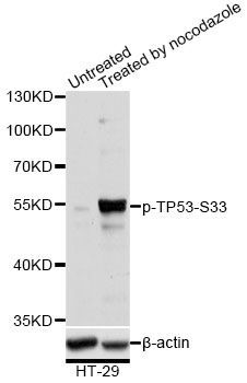 Western blot - Phospho-TP53-S33 pAb (144-61510)