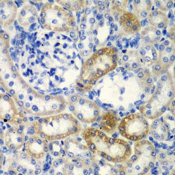 Immunohistochemistry - DCTD antibody (144-05889)
