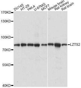 Western blot - LZTS2 antibody (144-60721)