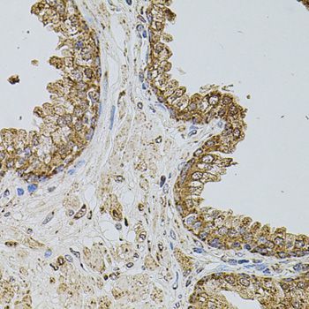 Immunohistochemistry - SELP antibody (144-01425)