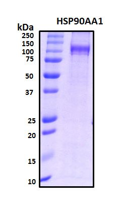 SDS-PAGE