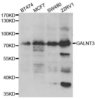 Western blot - GALNT3 antibody (144-06596)