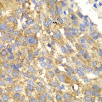 Immunohistochemistry - EIF2AK4 antibody (144-07155)