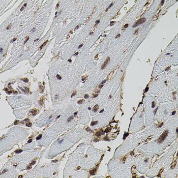 Immunohistochemistry - EIF4G2 antibody (144-02897)