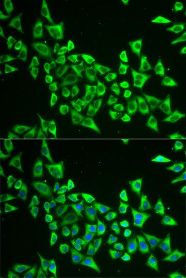 Immunofluorescence - MRPS30 Polyclonal Antibody (144-05841)