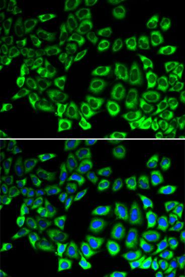 Immunofluorescence - AIMP1 antibody (144-05301)