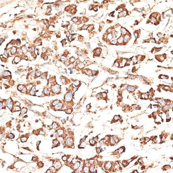 Immunohistochemistry - KIR3DS1 antibody (144-09936)