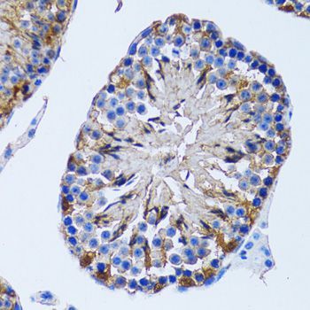 Immunohistochemistry - IMPA1 antibody (144-06381)