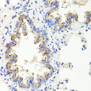 Immunohistochemistry - SHH antibody (144-07726)