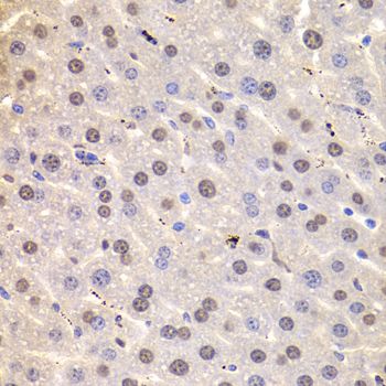 Immunohistochemistry - HNRNPD Polyclonal Antibody (144-01828)