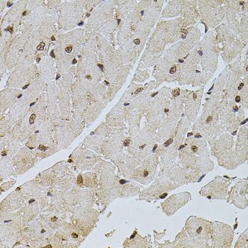 Immunohistochemistry - PPP2R5C antibody (144-05480)