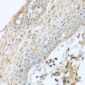 Immunohistochemistry - NDUFA2 antibody (144-08136)