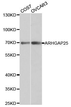Western blot - ARHGAP25 antibody (144-01223)