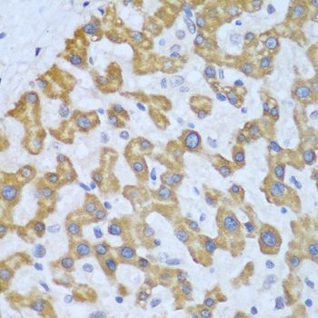Immunohistochemistry - PRKCD Polyclonal Antibody (144-00471)