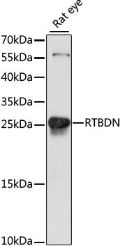 Western blot - RTBDN antibody (144-61095)
