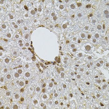 Immunohistochemistry - PPP2R5C antibody (144-05480)