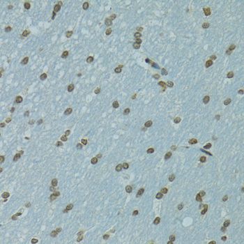 Immunohistochemistry - AHR antibody (144-01451)