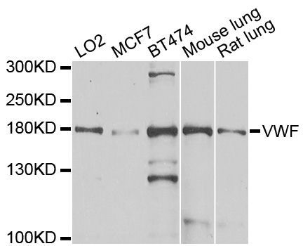 Western blot - VWF antibody (144-60297)