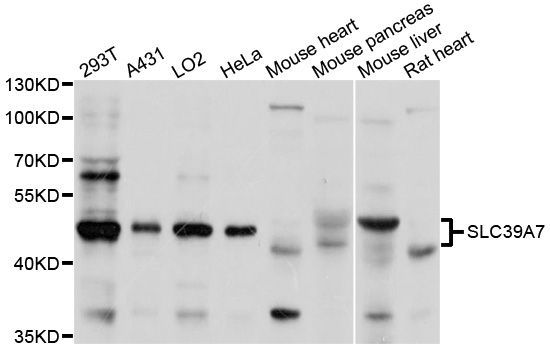 Western blot - SLC39A7 antibody (144-03343)
