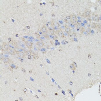 Immunohistochemistry - CHGA antibody (144-61314)
